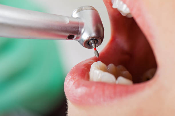 Best Walk-In Emergency Dentist in Moore, OK